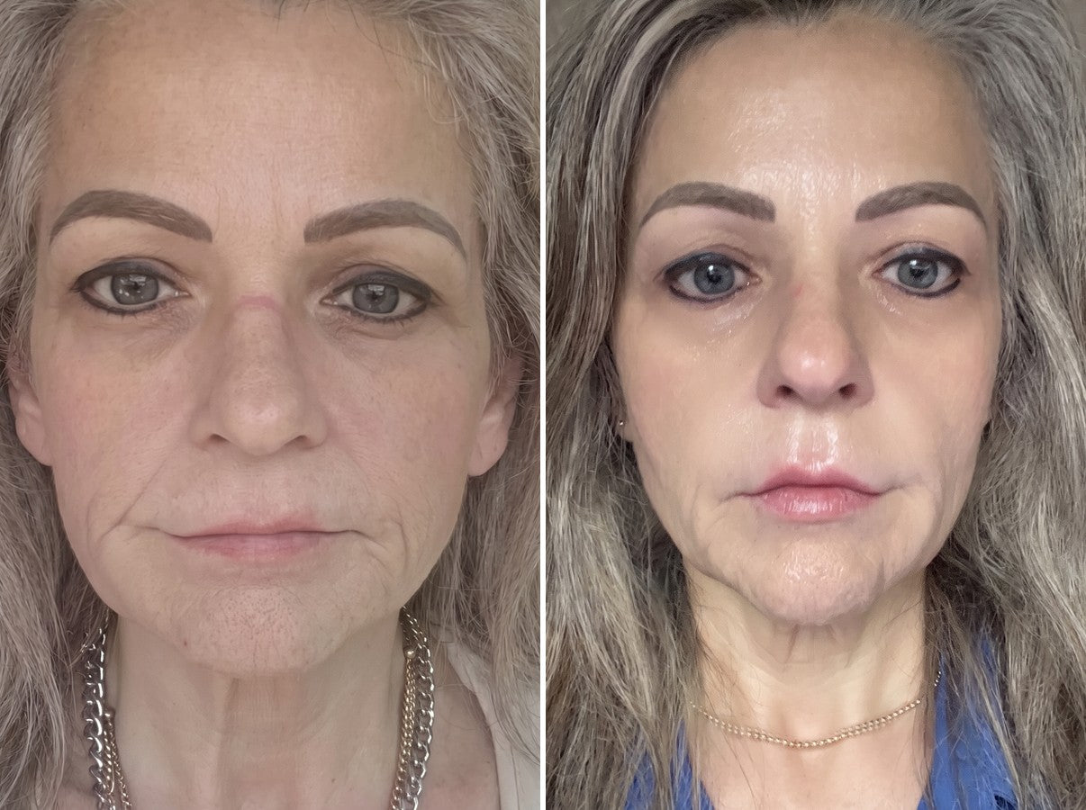 Prima e dopo, Wendy